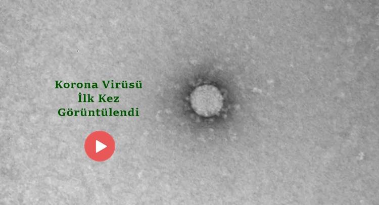 Koronavirüsün İlk Mikroskop Görüntüleri Paylaşıldı
