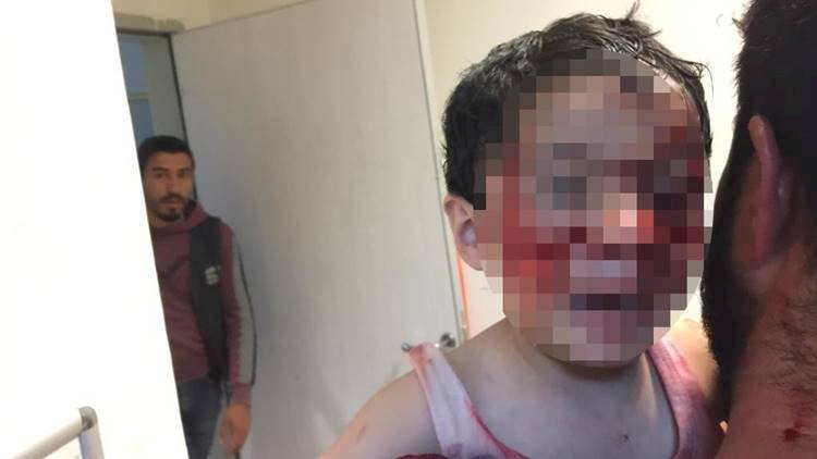Viranşehir'de Başıboş Köpekler Çocuklara Saldırdı 3'ü Ağır 6 Çocuk Yaralandı