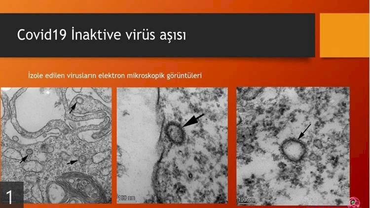 Eleştirilerin Odağındaki Ercüment Ovalı Geliştirdiği Aşıyı Paylaştı