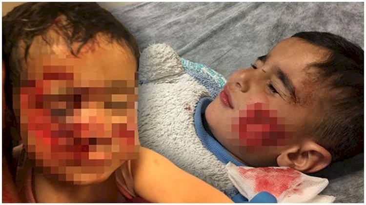 Viranşehir'de Köpeklerin Saldırısına Uğrayan Çocuklardan Biri Hayatını Kaybetti