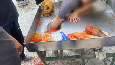 Şanlıurfa'da elini makinaya kaptıran genç kız kurtarıldı