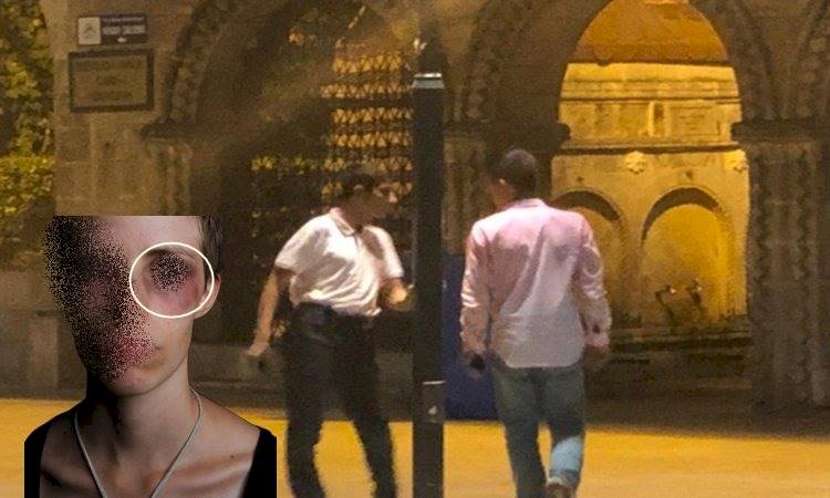 Şanlıurfa'ya Gelen Bayan Turist Balıklıgöl’de Darp Edildi
