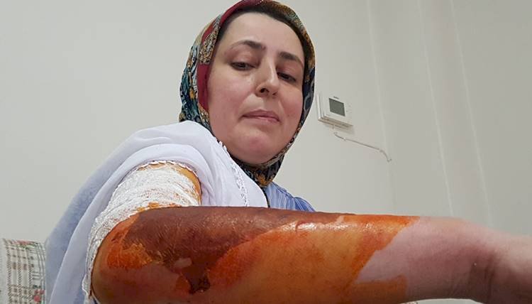 Misafirinin Yanında Oturmayan Eşine Kaynar Su Döktü
