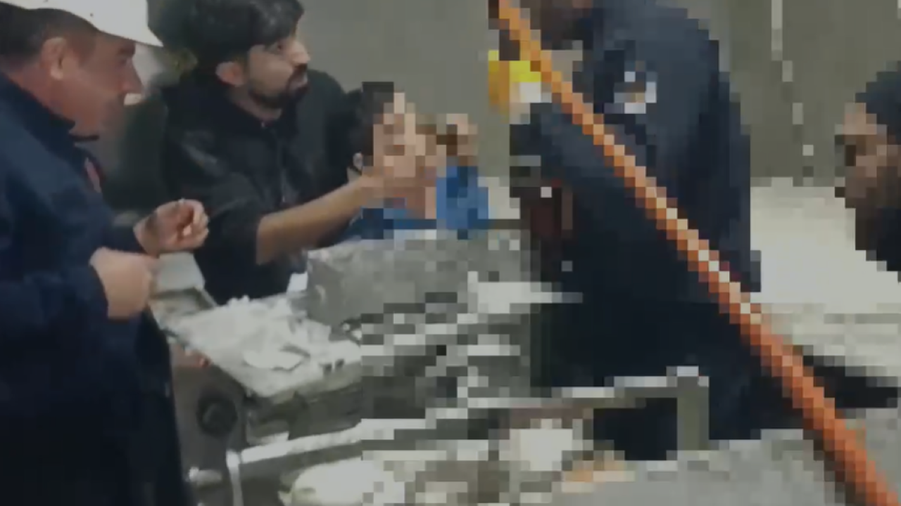 Şanlıurfa'da kolunu hamur makinesine kaptıran çocuğu itfaiye kurtardı