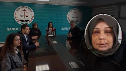 Şiddet mağduru kadına Şanlıurfa Barosu'ndan destek